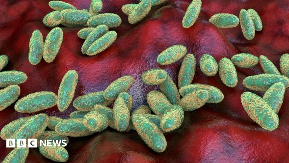 Deadly Respiratory Infection Sparks Global Concern After Laboratory Fatality